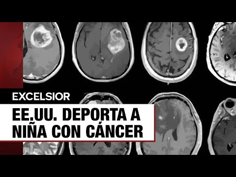 EE.UU. deporta a niña con cáncer cerebral; viajaba por tratamiento