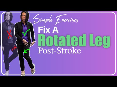 Correcting Outward LEG ROTATION After Neurologic Injury