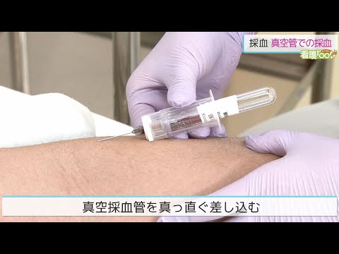 真空管での採血 ／ 監修 日本医療大学