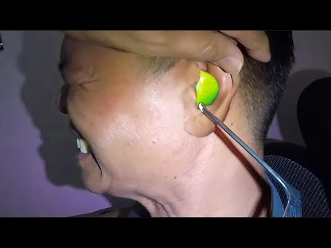 something huge is stuck in his ear..