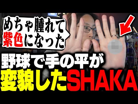 The k4sen Baseballを終えて、手のひらが凄いことになっていたSHAKA【ARK: Survival Ascended】