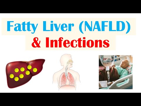 Non-Alcoholic Fatty Liver Disease & Infections | Immunity, Types of Infections