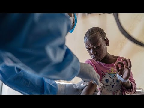 Mpox outbreak hits Kabare amid ongoing conflict in DRC