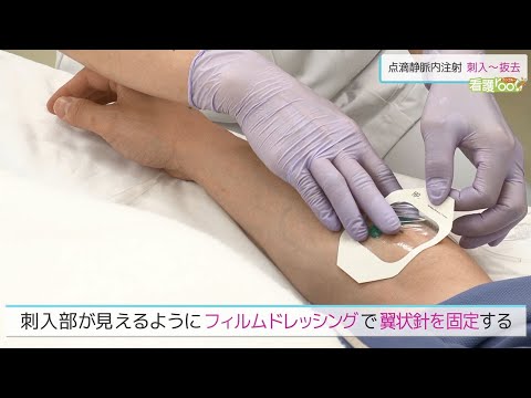 点滴静脈内注射ー刺入から抜去まで ／ 監修 日本医療大学