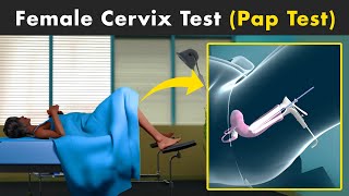 Why Pap Test Is Performed? | Pap Smear Test For Cervical Screening