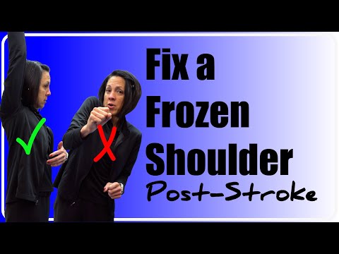 Fixing a "frozen shoulder" Post Stroke