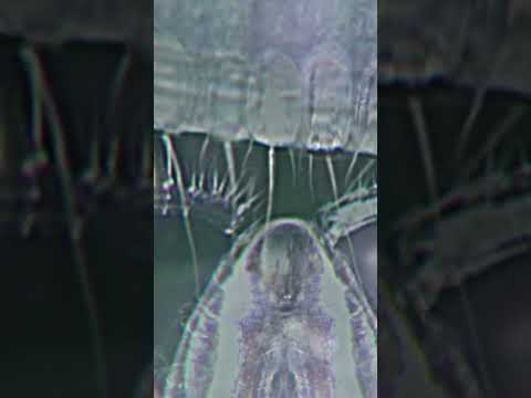 Jellyfish Stings Under Microscope ଳ😮#shorts