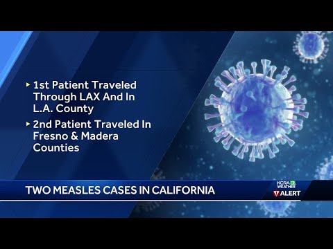 Measles cases reported in Fresno and Los Angeles counties