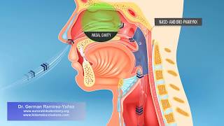 Mouth Breathing in Children from Dr. German Ramirez