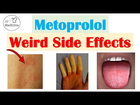 Metoprolol (& Beta Blockers) Weird Side Effects (Skin, Gastrointestinal, Psychological)