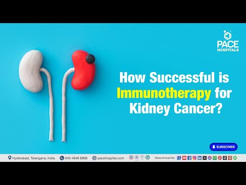 How Successful is Immunotherapy for Kidney Cancer? | Immunotherapy Treatment for Kidney Cancer