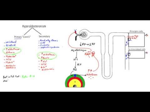 Conn's syndrome (Primary Hyperaldosteronism) - MADE EASY