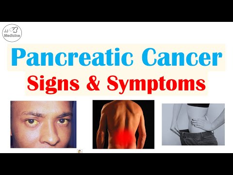 Pancreatic Cancer Signs & Symptoms (& Why They Occur)