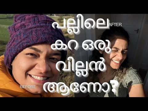 Honest Review🫶 Clean and White teeth😍 Remove Stain and Boost confidence🫰പല്ലിലെ കറ ഒരു വില്ലൻ ആണോ???