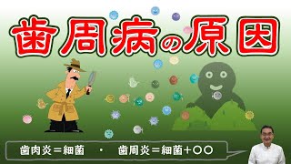 歯周病の原因・歯肉炎は細菌ですが歯周炎は分かっていません