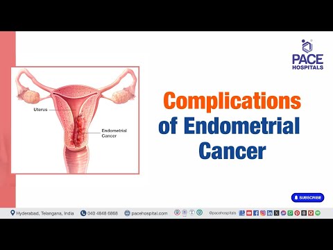 Complication of Endometrial Cancer | Risk of untreated Endometrial Cancer  #endometrialcancer