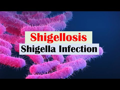 Shigellosis (Shigella) “A Cause of Bloody Diarrhea”: Pathophysiology, Symptoms, Diagnosis, Treatment