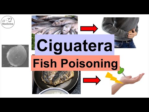 Ciguatera Fish Poisoning (Ciguatoxin) | Symptoms (Numb Feet, Diarrhea), Diagnosis, Treatment