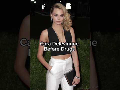 Cara Delevingne before and after drugs 💔 ❤️‍🩹  #modelingagency  #drugaddiction #caradelevingne