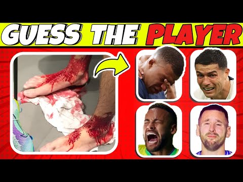 Who Got INJURY? 😭Comparison INJURY Moments of Football Player! Football Quiz | Mbappe, Ronaldo,Messi