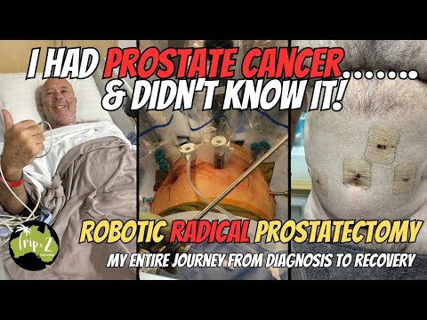 PROSTATE CANCER - My full journey from Diagnosis to Recovery - Ep 69