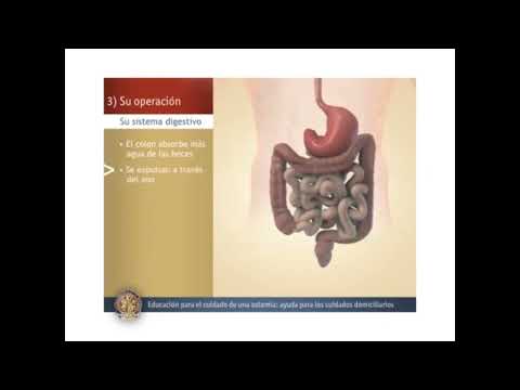 3. Colostomía/Ileostomía: Su Operación