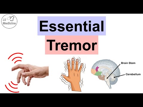 Essential Tremor | Causes, Pathophysiology, Symptoms, Exacerbating Factors, Diagnosis, Treatment