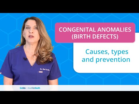 Congenital anomalies (birth defects): Common types with Dr. Beth  | AboutKidsHealth at SickKids