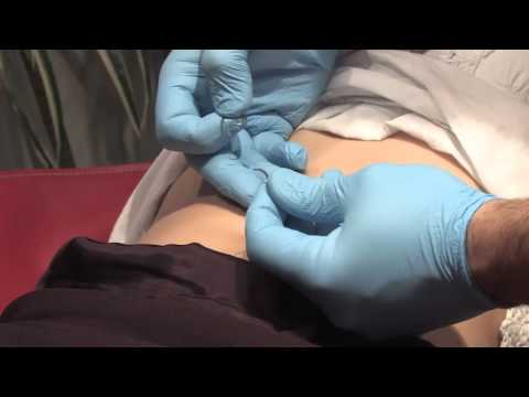 How to Change a Navel Ring