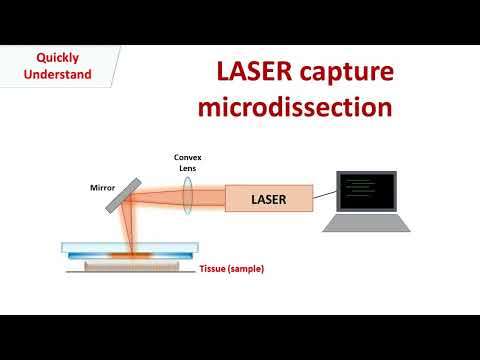 Laser capture microdissection