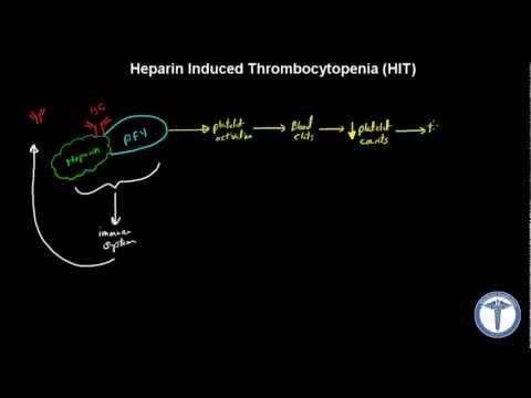 Heparin Induced Thrombocytopenia (HIT) Explained - MADE EASY