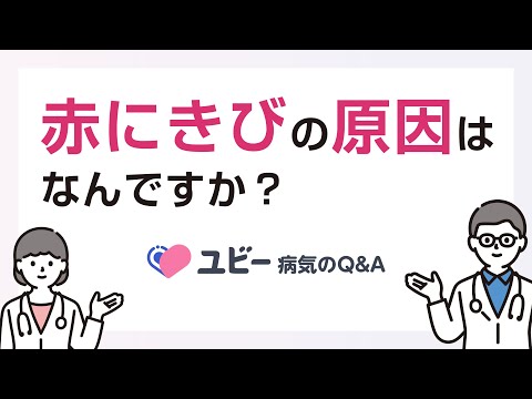 赤にきびの原因はなんですか？【ユビー病気のQ&A】