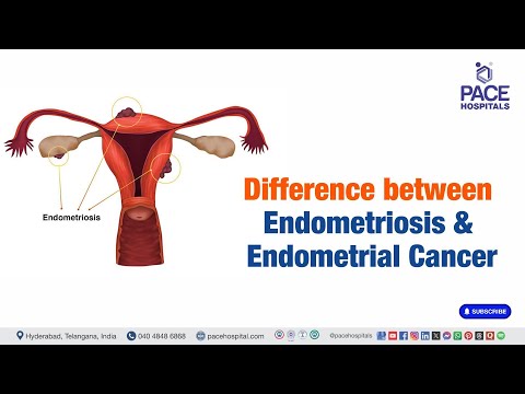 Difference between Endometriosis & Endometrial Cancer | Endometriosis vs Endometrial Cancer