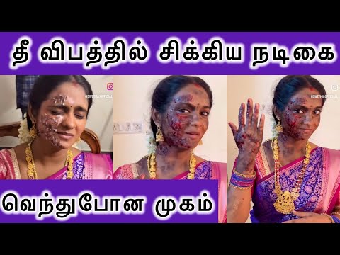 சின்ன மருமகள் சீரியல் நாயகியின் பரிதாப நிலை