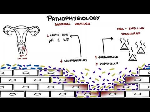 Bacterial Vaginosis