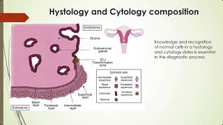 Cervical Cancer HPV induced