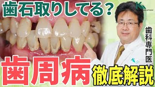 【歯石落とせてますか？】歯周病はどうやって治せばいいのか？歯科医が解説