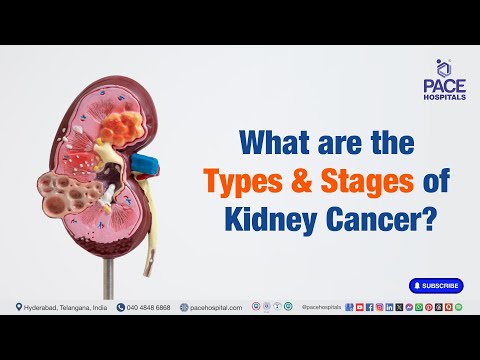 Kidney Cancer (Renal Carcinoma) - Type & Stage | Type of Kidney Cancer | Stage of Kidney Cancer