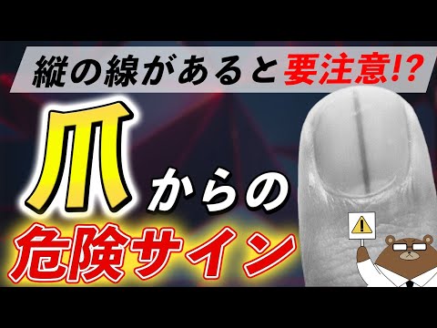 放置厳禁！知らないと後悔する「爪」からのSOSサイン。その知られざる意味とは？