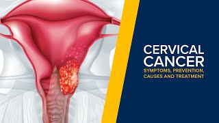 Cervical Cancer and HPV - Symptoms, Causes and Prevention Explained