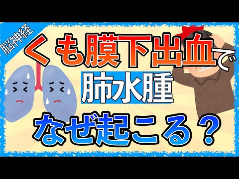 イラストで学ぶ医学！「くも膜下出血で肺水腫になる理由とは」