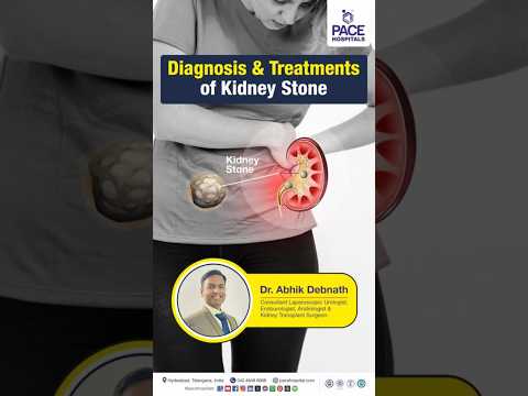 Kidney Stones Disease - Diagnosis & Treatment | Kidney Stone Diagnosis | Kidney Stone Treatments