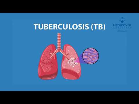 Tuberculosis Warning Signs You Should Never Ignore | Medicover Hospitals