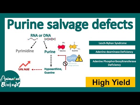 Purine Salvage Defects | Lesch-Nyhan Syndrome | Adenosine deaminase (ADA) deficiency