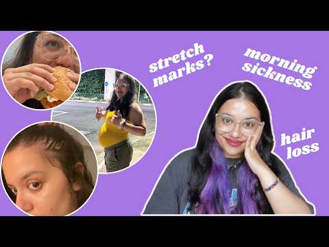 things people don't tell you about getting pregnant lol | stretch marks, hospital bag, hair loss