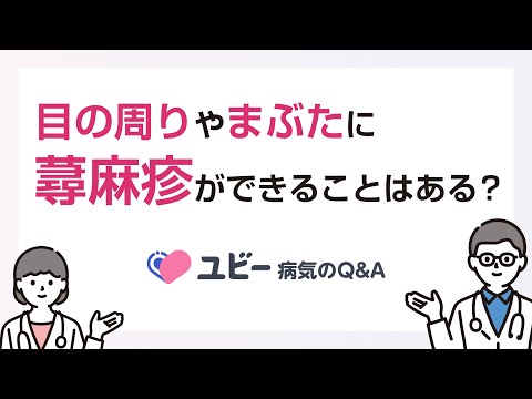 目の周りやまぶたに蕁麻疹ができることはありますか？【ユビー病気のQ&A】