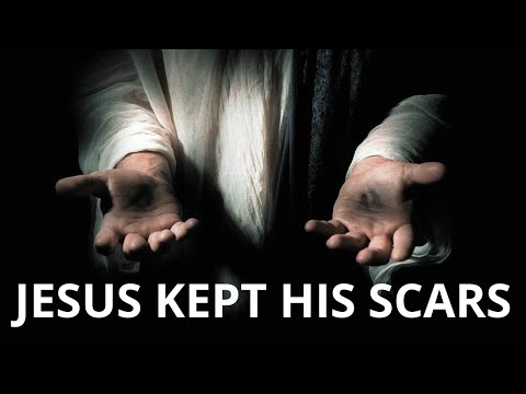 JESUS KEPT HIS SCARS | Your Scars Are Proof That God Heals - Inspirational & Motivational Video