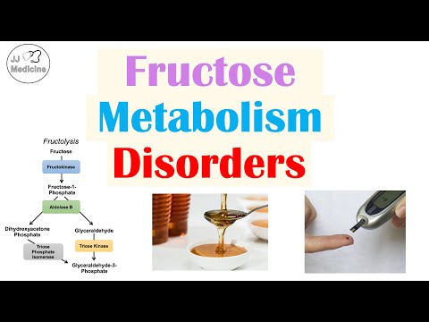 Fructose Metabolism Disorders | Essential Fructosuria & Hereditary Fructose Intolerance