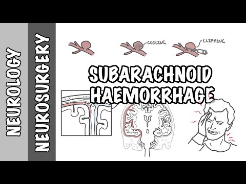 Subarachnoid Haemorrhage / pathophysiology, complications and management