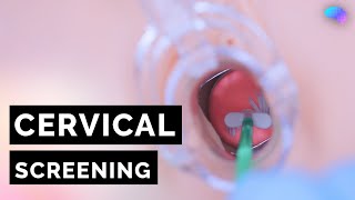 Cervical Screening (Smear) | HPV | OSCE Guide | UKMLA | CPSA | PLAB 2